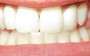 Higiene dentária – cuidados com os dentes