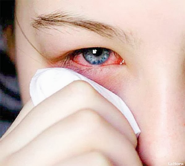 alergia nos olhos