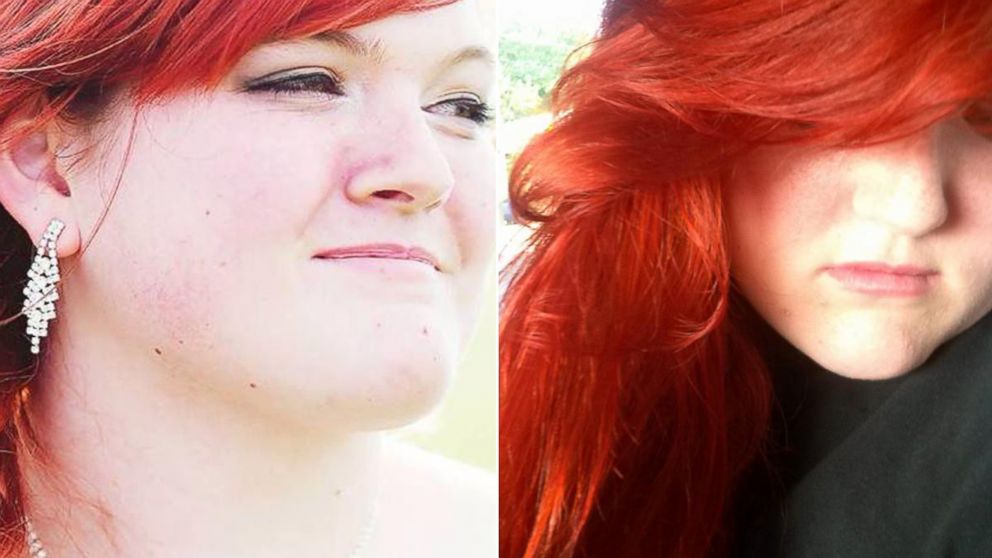 Estudante nos EUA é expulsa por ter cabelo vermelho 2