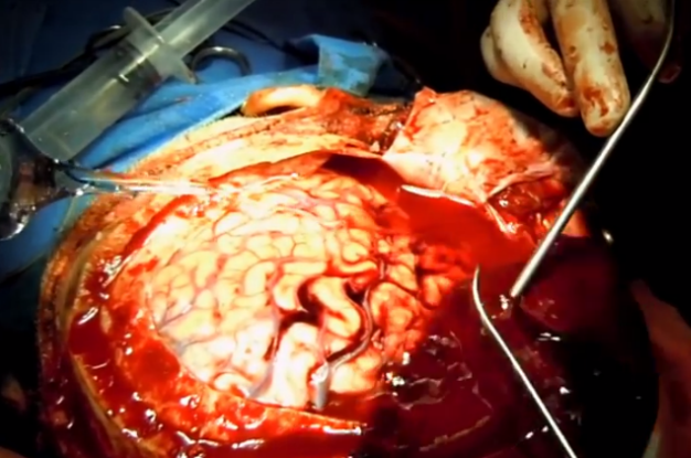 Neurocirurgião