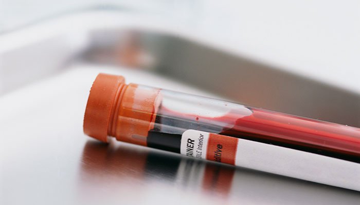 Exames que você realizar todo ano