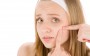 Por que fazer tratamentos de acne?