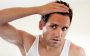 Queda de cabelo masculino: Possíveis causas