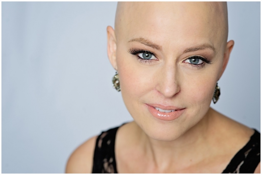 Remédio para calvície existe