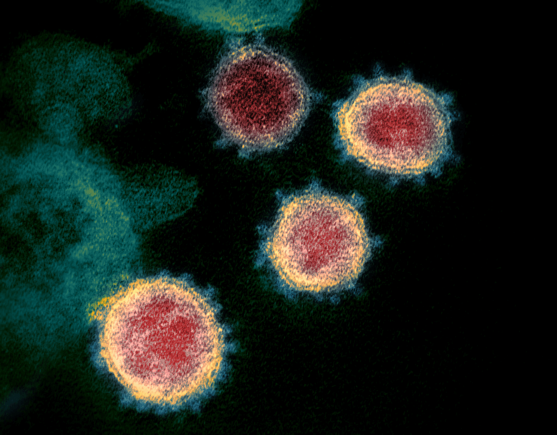 Cientistas descobrem anticorpo que bloqueia infecção por Sars-CoV-2